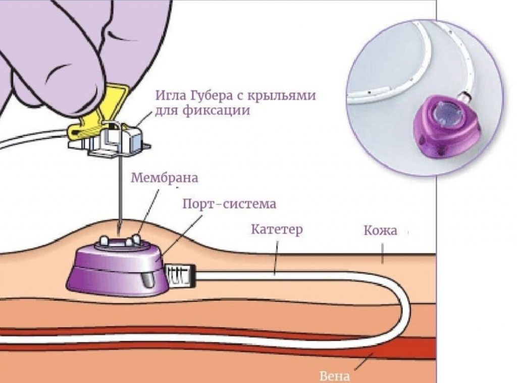 порт-система